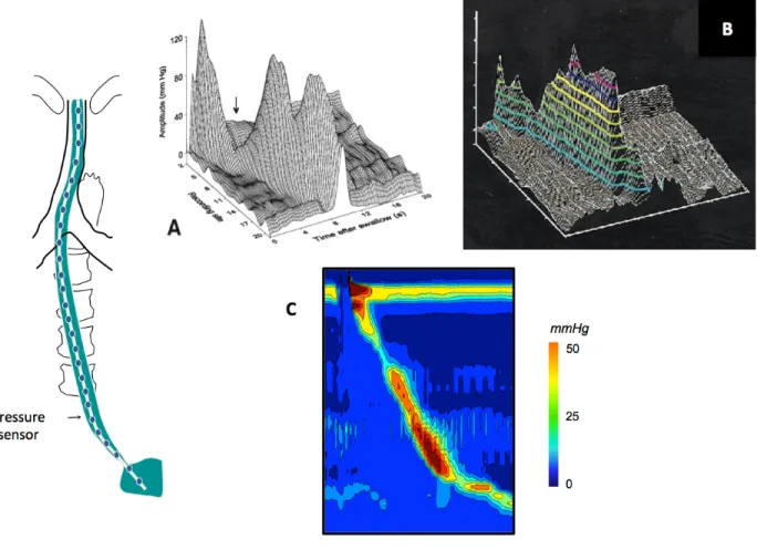 Figure 5.    Description of the esophageal pressure topography. 