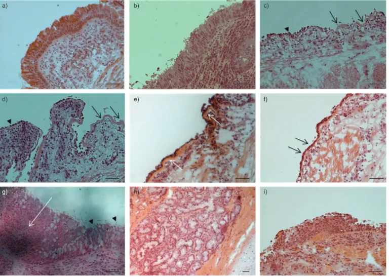 FIGURE 1. Airway epithelial alteration and remodelling in cystic fibrosis (CF) patients