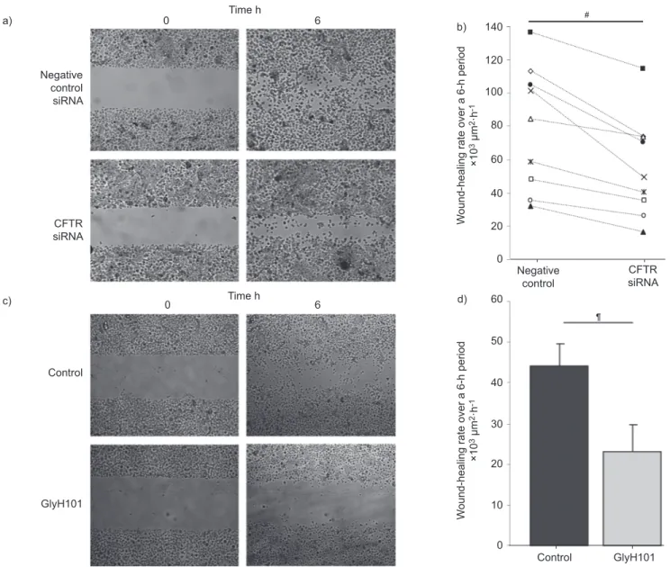 FIGURE 4. Decreased wound healing after cystic fibrosis transmembrane conductance regulator (CFTR) silencing and inhibition in primary airway cell monolayers