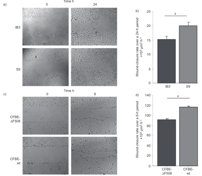 FIGURE 6. Increased wound-healing capacity after cystic fibrosis transmembrane conductance regulator (CFTR) correction in cystic fibrosis (CF) cell lines
