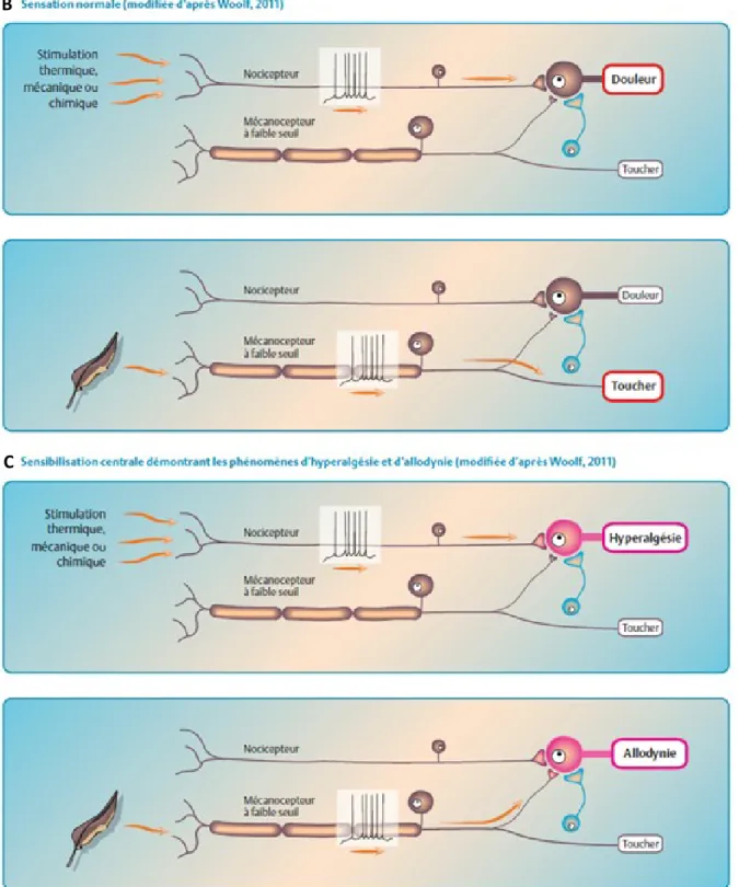 Figure  4 :  Sensibilisation  périphérique  et  centrale.  (A)  Sensibilisation  périphérique;  (B) 