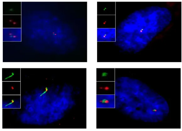 Figure  5:  CEP78  localizes  to  the  distal  end  of  centrioles.  RPE  cells  are  fixed  and  stained  with 