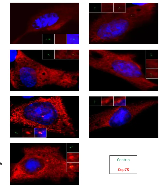 Figure 7: LRRs are necessary for centrosomal localization. RPE cells are  transfected with 
