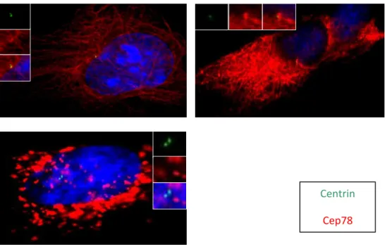 Figure 8: Some fragments show a) microtubule binding b) aggregate formation. RPE cells  are  transfected  with  flag  tagged  CEP78  fragments,  fixed  and  stained  with  flag  and  Centrin