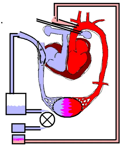 Figure 1: Schéma illustrant le fonctionnement de la CEC. Le sang désoxygéné arrive vers  l'oreillette droite et est dérivé par une canule (en bleu)