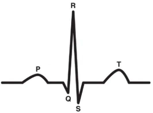 Figure  1-7: The  components  of  a  normal  electrocardiogram  (ECG).  P:  atrial  depolarization;  QRS: ventricular depolarization; T: ventricular repolarization.