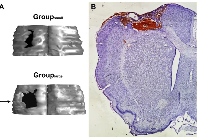 Figure 3. Histological reconstruction of lesions. For each animal, one out of six sections were  reconstructed using Neurolucida software (Microbrightfield, inc.) to calculate the effective lesion  volume