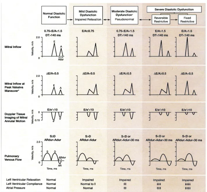 Figure 1 : Les paramètres échocardiographiques utilisés dans l’évaluation de la DD.  