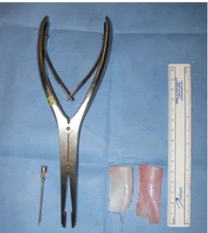 Figure 6: Canule d’injection, morséliseur de cartilage, rectangles cartilagineux et règle (de  gauche à droite) 