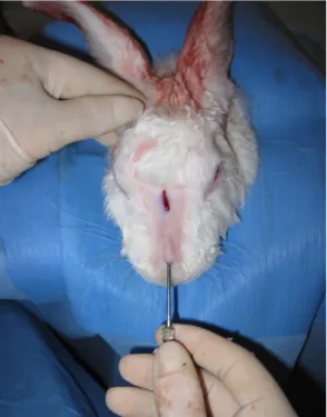 Figure 7: Fermeture du site d’implantation du cartilage entier (dorsum supérieur) et  injection percutanée du cartilage broyé (dorsum inférieur) 