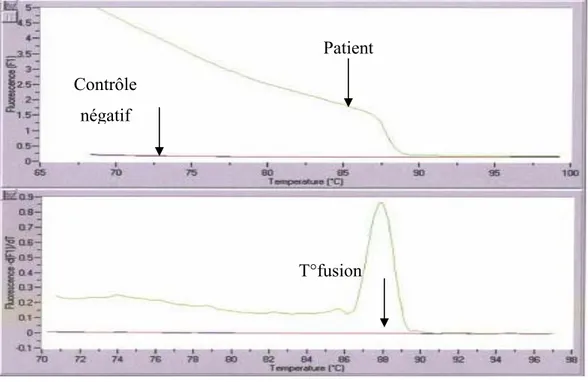 Figure 9 : Courbe de dénaturation et courbe de fusion  