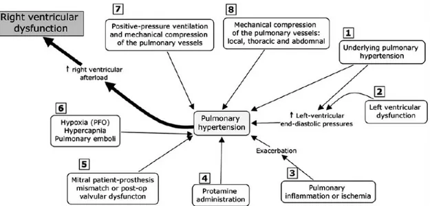 Figure	
  6:	
  The	
  most	
  common	
  mechanisms	
  contributing	
  to	
  pulmonary	
  hypertension	
  in	
  