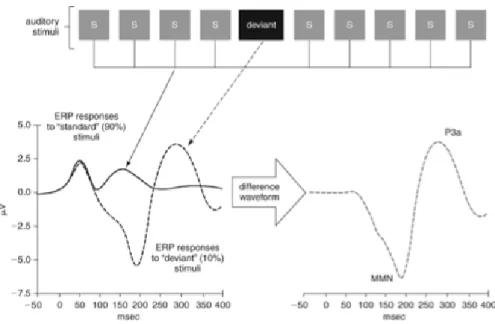 Figure 5 - Obtention de la courbe de différence en soutrayant la courbe du standard de la  courbe du déviant (Light et al., 2010) 