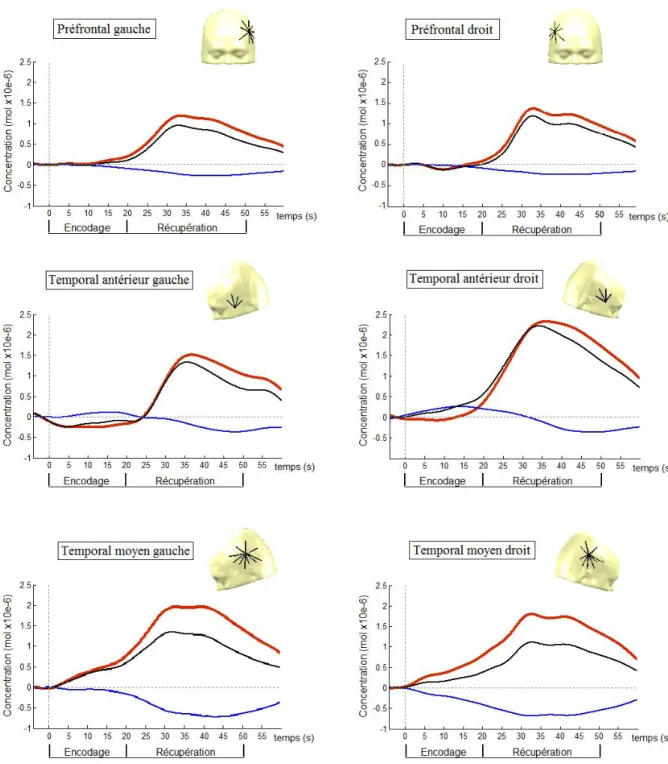 Figure  9.  Décours  temporel  de  la  réponse  hémodynamique  lors  de  l’encodage  des  mots 
