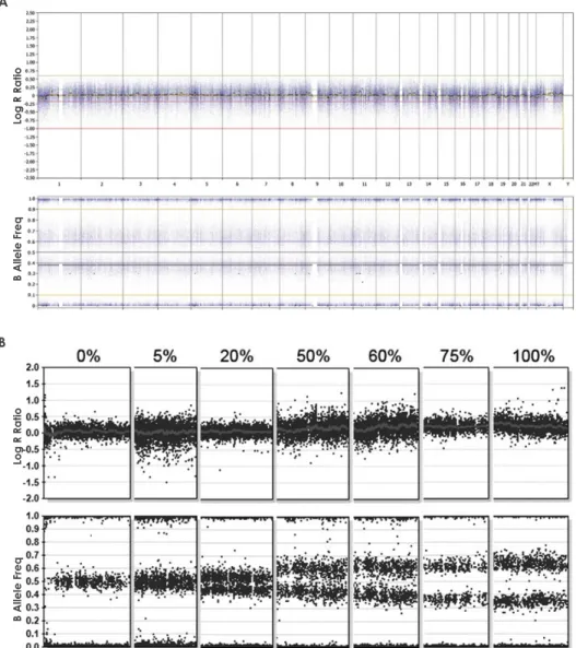 Figure 1-8 : Patrons de fréquence de l’allèle B (BAF : B Allele Frequency) et log ratios  détectés par les micropuces SNP en cas de polyploïdie et de mosaïcisme