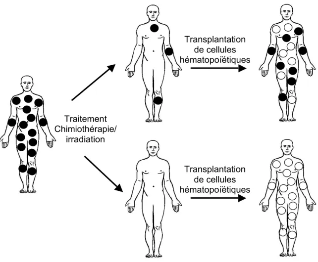 Figure  1.3 :  Transplantation  de  cellules  hématopoïétiques  d’un  donneur  à  un  receveur  après  traitement  chimiothérapie/irradiation