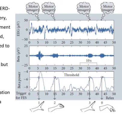 Figure 5-5: FES controlled by thoughts [74]