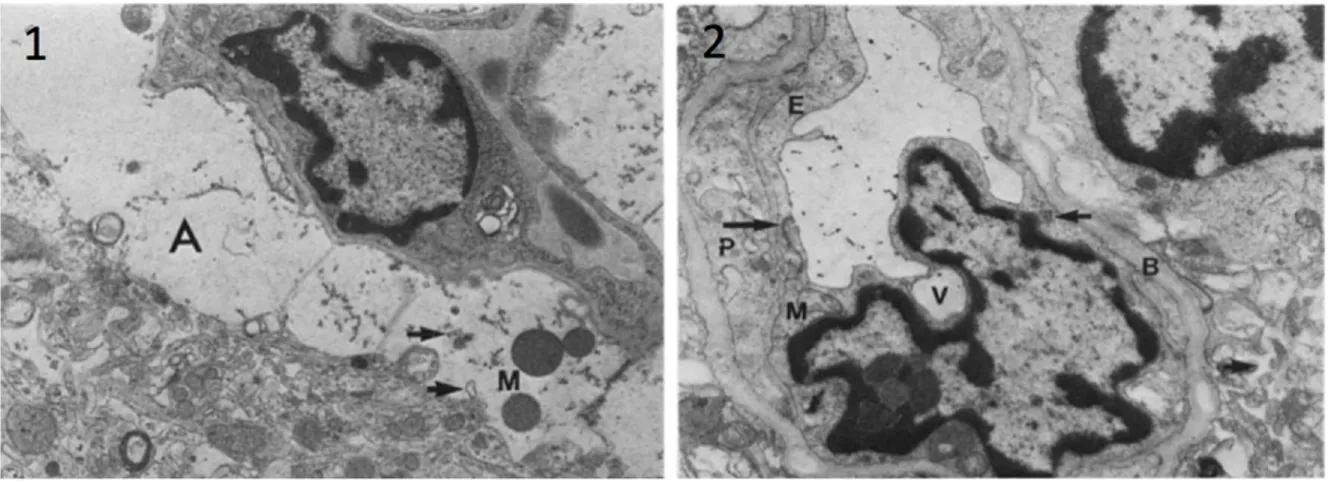 Figure  1.2 :  Conséquences  neuropathologiques  de  l’insuffisance  hépatique  aiguë