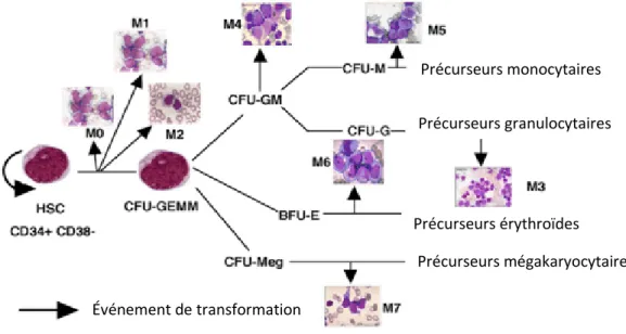 Figure 2 : Classification des LMA selon le système de classification FAB 