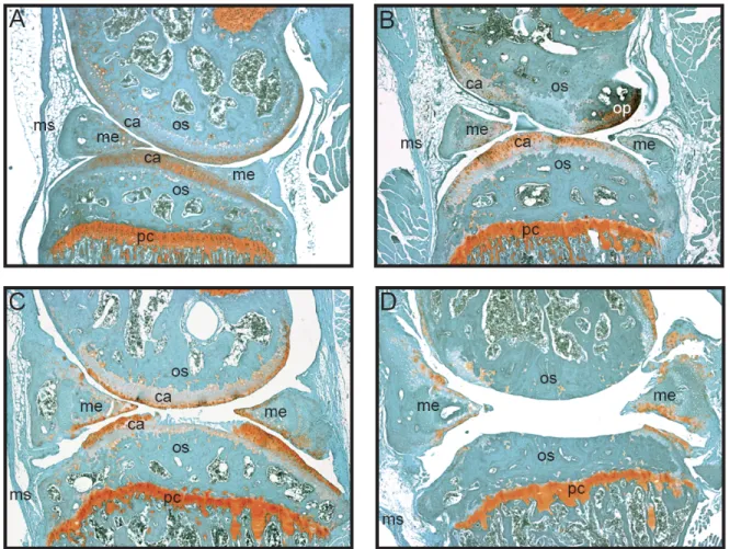Figure 1. Développement progressif de l'arthrose chez les souris STR/ort.  