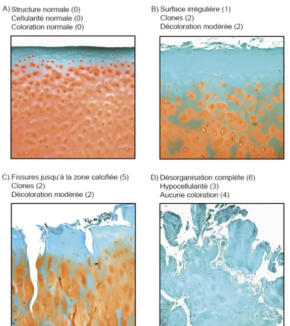 Figure 3. Évaluation des dommages arthrosiques cartilagineux selon Mankin. 