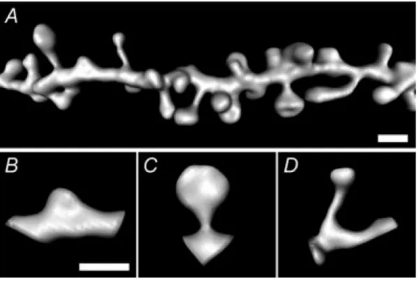 Figure  9:  Exemples  d'épines  dendritiques  de  morphologies  différentes:  stubby  (b),  mushroom (c) et thin (d)