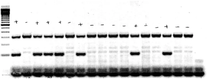 Figure 8: A gel image for the Ap2-Cre recombinase genotyping PCR 