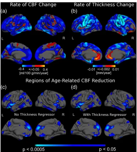Figure 16. The association between age and regional CBF as well as cortical thickness