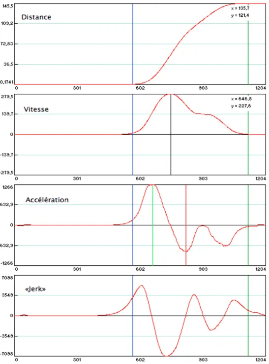 Figure 2 : Illustration d'un profil cinématique ne présentant aucune correction  consciente.