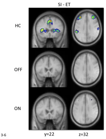 Figure 21: Location of peaks associated with the cognitive portion of SI movements 