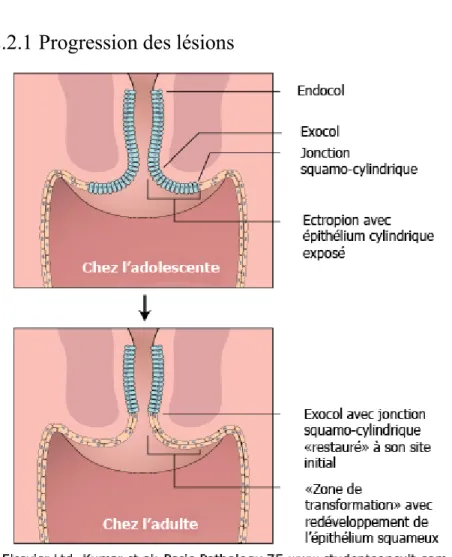 Figure 7 : Schéma de la zone de transformation. 