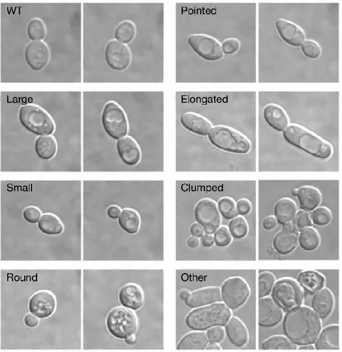 Figure  6 :  Saccharomyces  cerevisiae,  a  biological  model,  allowing  the  visualization  of  seven distinct phenotypes