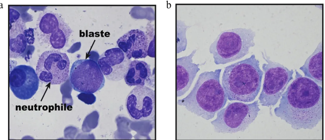 Figure 1.4 Morphologie de cellules hématopoïétiques. a. moelle normale humaine. b.  Lignée cellulaire myéloïde MONO-MAC-1, avec réarrangement MLL-AF9