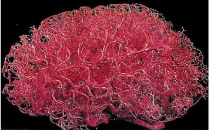 Figure 2 - Vascularisation du cerveau humain. Présentation de la haute densité de vaisseaux sanguins dans le cerveau