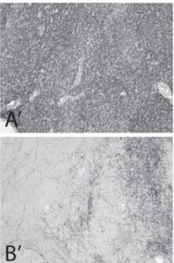 Figure 2 – Micrographs from TH-immunostained sections at a more rostral transverse  level than in Figure 1, illustrating the nAcb and NStr in P15 and P90 rats, normal or  neonatally lesioned with 6-OHDA 