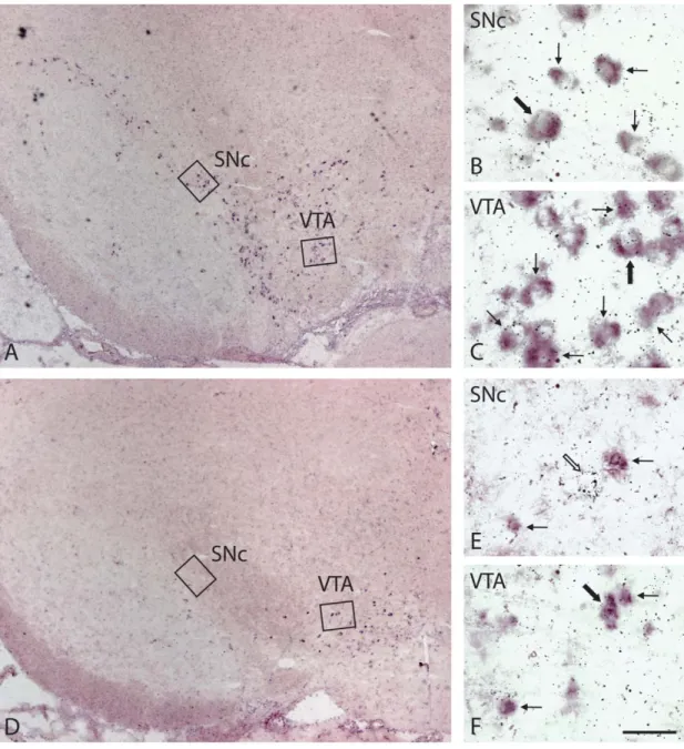 Figure 3 – Expression of TH and VGLUT2 mRNAs in SNc and VTA neurons of 90- 90-day-old normal or neonatally 6-OHDA-lesioned rats 