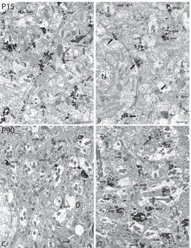 Figure 4 – Low-magnification electron micrographs illustrating immunoreactive axon  terminals (varicosities) in the nAcb of P15 and P90 rats, normal or neonatally 