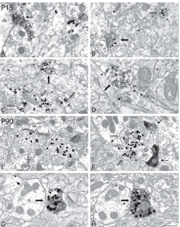 Figure 6 – Axon terminals from the nAcb of P15 and P90 rats neonatally lesioned  with 6-OHDA, after dual immunolabeling for TH (immunoperoxidase-DAB) and  VGLUT2 (immunogold) 