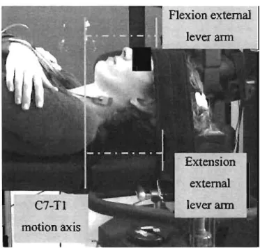Fig.  3 Extemal lever of arms. 