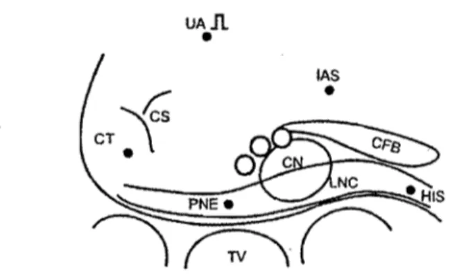 Figure 9  : Schéma de la préparation expérimentale, du site de stimulation (onde  rectangulaire dans l'oreillette haute) et des sites d'enregistrement (cèrcles noirs),  ainsi que des sites de lésions pour ablation de la voie rapide (cercles blancs)