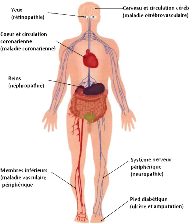 Figure  2.  Représentation  des  organes  atteints  par  les  principales  complications  diabétiques