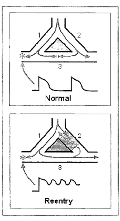 Figure  1.2:  Schematic  diagram  of  reentry.  Top  panel:  normal  propagation,  the  excitation  propagates through branches  1 and  2,  and  dies  out at position  3