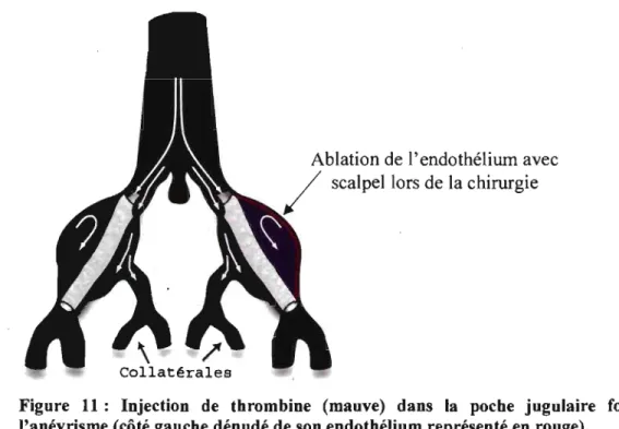 Figure  11:  Injection  de  thrombine  (mauve)  dans  la  poche  jugulaire  formant  l'anévrisme (côté gauche dénudé de son endothélium représenté en  rouge)