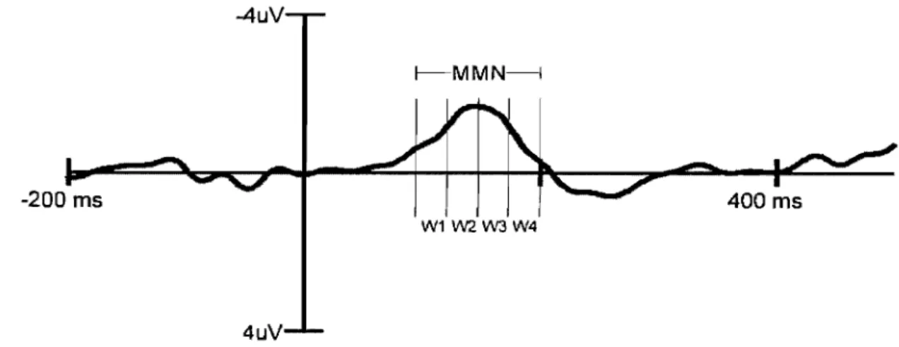 Figure  5:  Illustration  des  fenêtres  temporelles  d'analyse  de  l'onde  MMN  typique