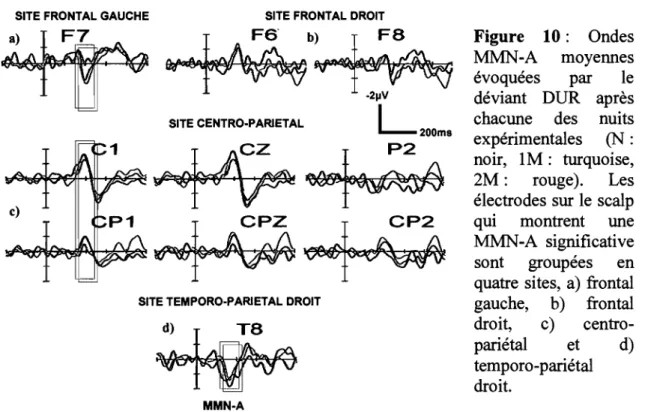 Figure  10:  Ondes 