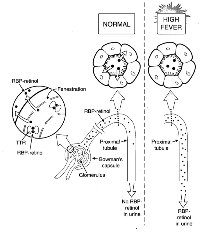Figure 1 : Mécanisme d'excrétion de la vitamine A dans les  urines  (Stephensen, 2001)  NORMAL  RBP-retinolV  \ 