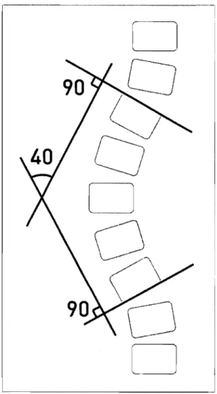 Figure 3  - Angle de Cobb 