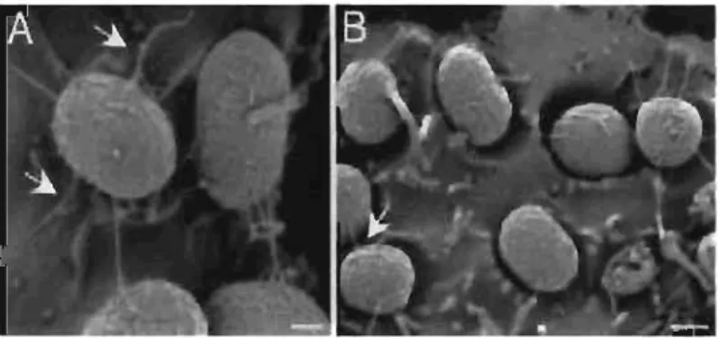 Figure 2:  Adhérence de E.  coli sur des cellules Hep-2 grâce au  fimbriae  Ecf  (visualisation en microscopie électronique, Rendon, 2007) 