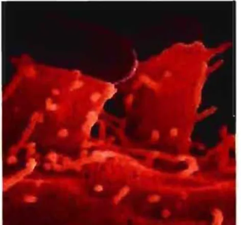 Figure 5  : Attachement intime d'une  EPEC sur des  cellules  intestinales 