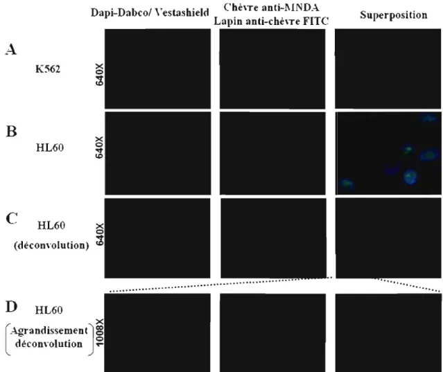 Figure 3 : Localisation cellulaire de MNDA  par la  technique d'immunofluorescence.  (A)  Contrôle négatif pour l'expression de MNDA, cellules K562; (B) Cellules exprimant  MNDA, cellules HL-60; (C)  Image de déconvolution des cellules HL-60;  (0) 